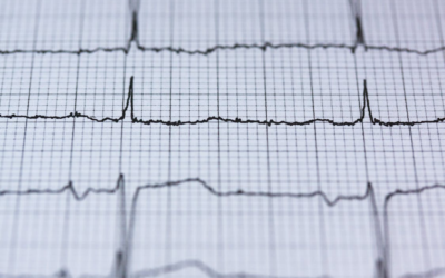 The Facts About Polygraphs