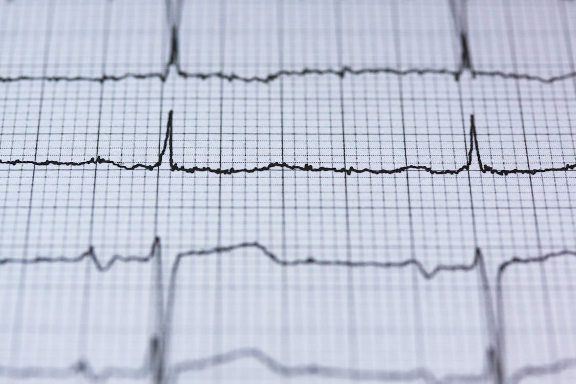 Close-up of printed polygraph-style chart lines on grid paper showing sharp response peaks